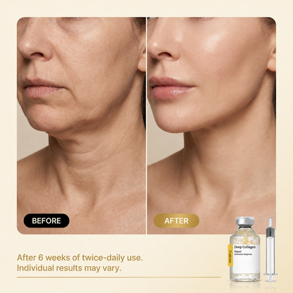 🔥LIMITED TIME🔥 BUY 1 GET 1 FREE｜Alisanda SilkThread Firming Ampoule Serum!!✨