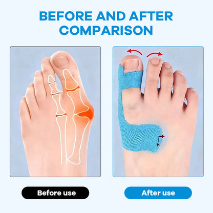 🔥Last Day - 49% Discount🔥 - Hallux Valgus Correction Kinesiology Patches